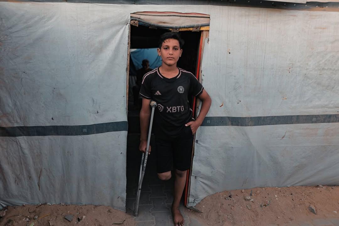 After Two Years of War In Gaza: A Childhood Buried Alive, Death, Displacement, and Starvation